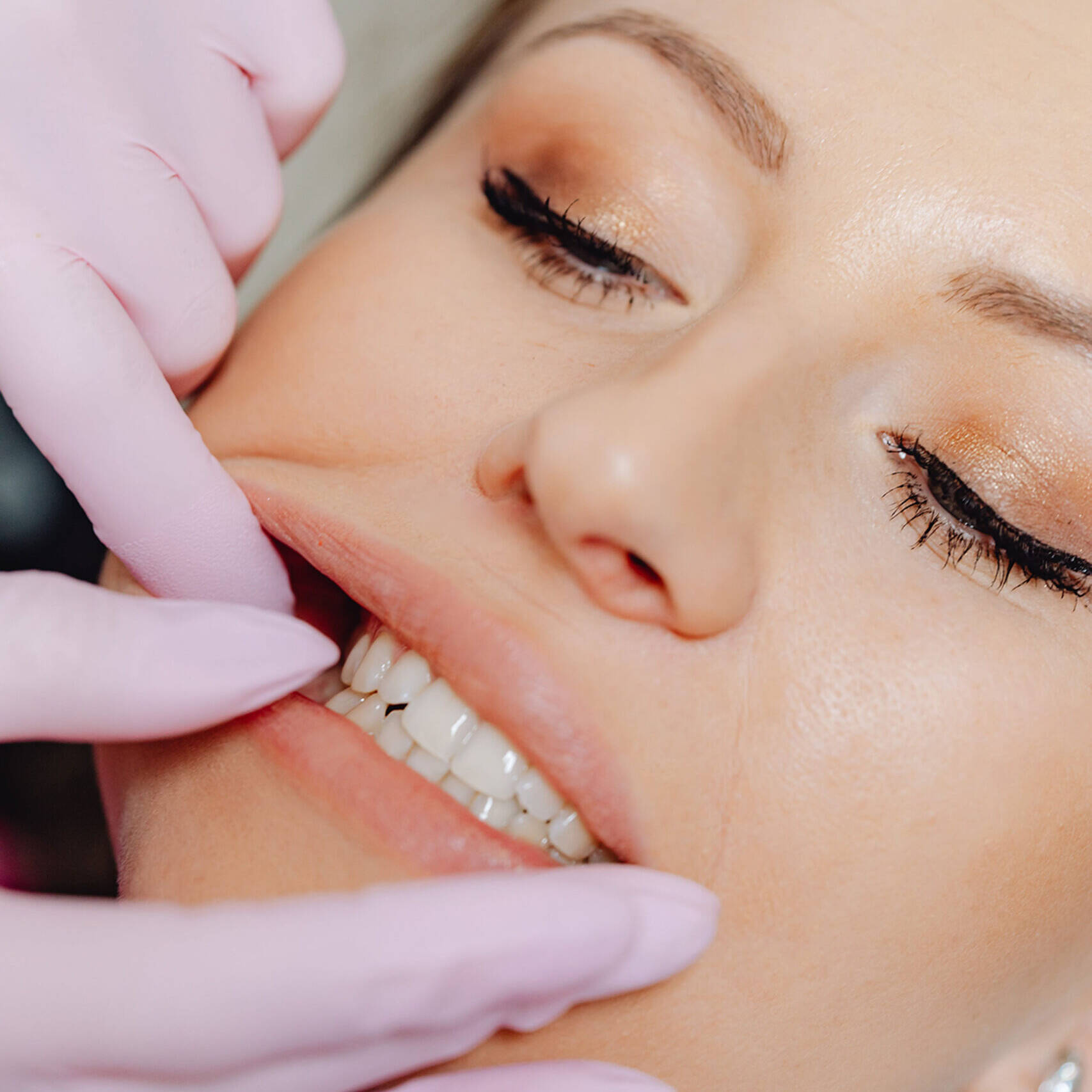 Sealen van tanden mondhygienist